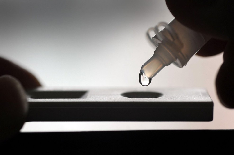 Kitajski znanstveniki naj bi razvili zelo natančen test za novi koronavirus (foto: profimedia)