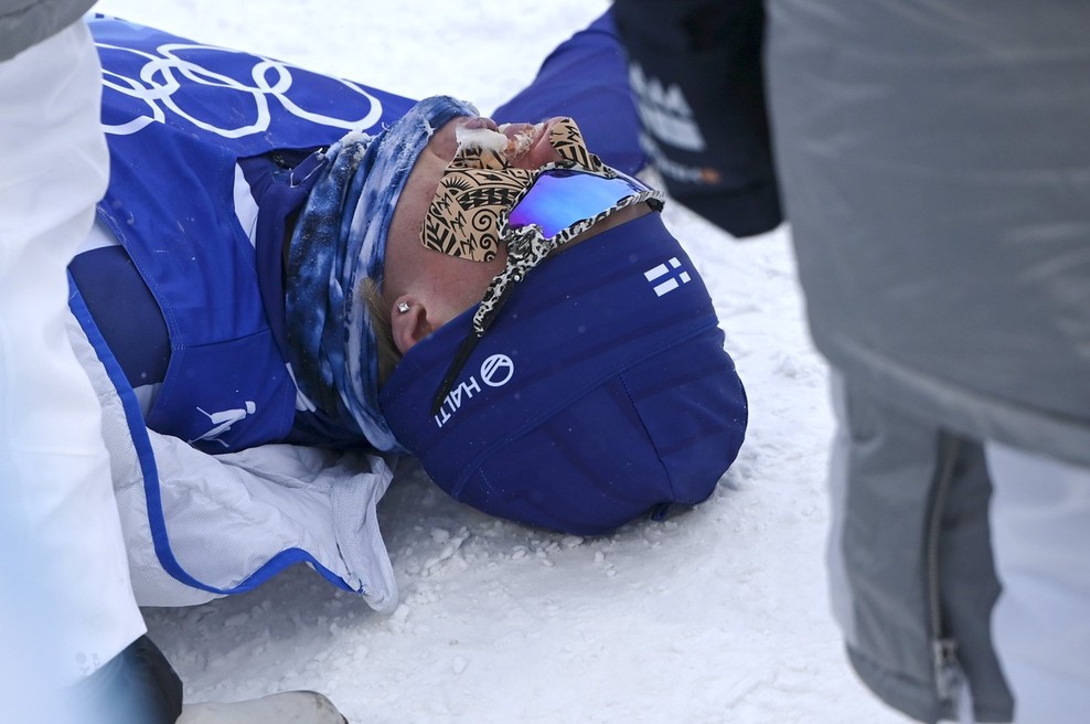 Olimpijski smučarski tekač doživel neverjetno: "Lahko ugibate, kateri del telesa mi je delno zmrznil!" (foto: Profimedia)