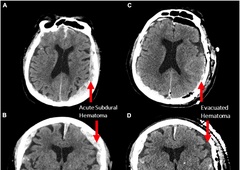 Raziskava z neverjetnim odkritjem: to se dogaja z našimi možgani 30 sekund pred smrtjo
