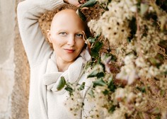 Za alopecijo trpi tudi znana Slovenka, ki je spregovorila o incidentu na oskarjih