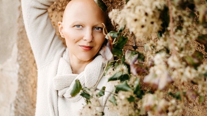 Za alopecijo trpi tudi znana Slovenka, ki je spregovorila o incidentu na oskarjih (foto: Mojfokus Neža Plestenjak)