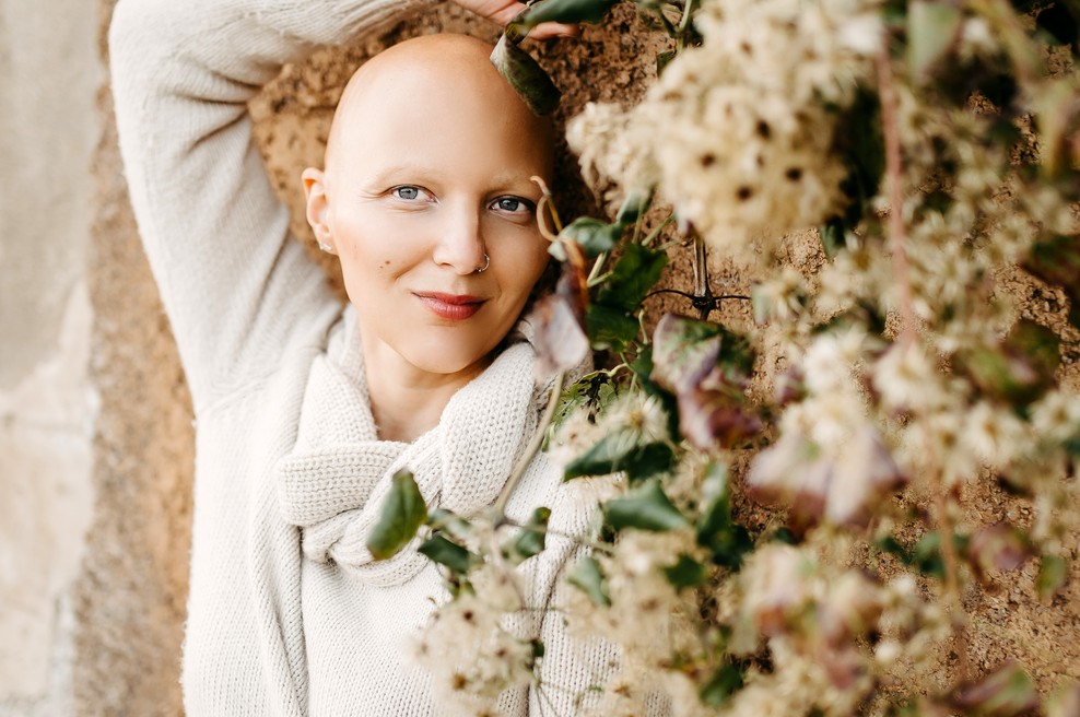 Za alopecijo trpi tudi znana Slovenka, ki je spregovorila o incidentu na oskarjih (foto: Mojfokus Neža Plestenjak)