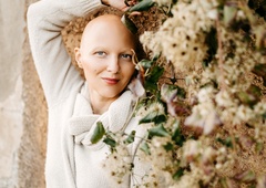 Za alopecijo trpi tudi znana Slovenka, ki je spregovorila o incidentu na oskarjih
