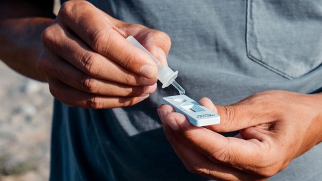 Zakaj nekateri ljudje preprosto ne zbolijo za covidom? Imunologinja razkrije neverjeten razlog