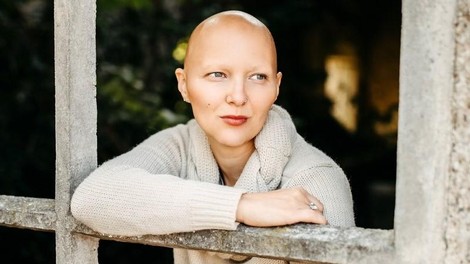 Mateja Osredkar o novem zdravilu za alopecijo: "Želim si zdravljenja vzrokov, ne simptomov."