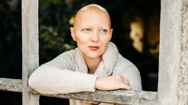 Mateja Osredkar o novem zdravilu za alopecijo: "Želim si zdravljenja vzrokov, ne simptomov." (foto: Mojfokus Neža Plestenjak)