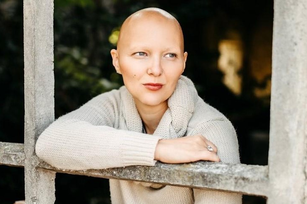 Mateja Osredkar o novem zdravilu za alopecijo: "Želim si zdravljenja vzrokov, ne simptomov." (foto: Mojfokus Neža Plestenjak)