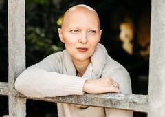 Mateja Osredkar o novem zdravilu za alopecijo: "Želim si zdravljenja vzrokov, ne simptomov."