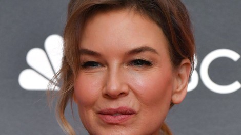 Dieta Renee Zellweger, s katero je v rekordnem času izgubila 48 kg