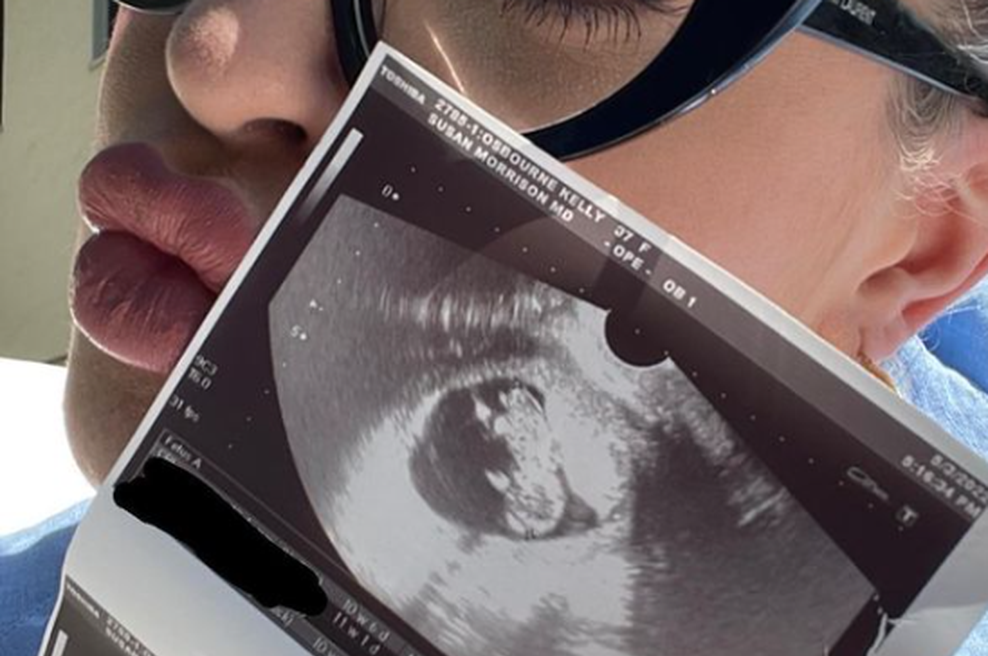 Čestitke letijo s vseh strani: slavna igralka pričakuje svojega prvega otroka (foto: Instagram Kelly Osbourne)