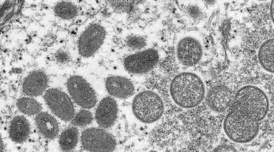 Virus opičjih koz. (foto: Profimedia)