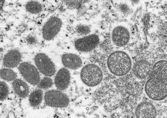 Primer opičjih koz potrjen že čisto blizu nas