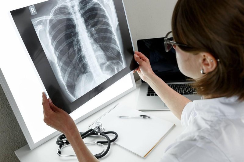 Živilo, ki čisti pljuča kot metla! Naše babice so ga uporabljale pri zdravljenju bolezni dihal