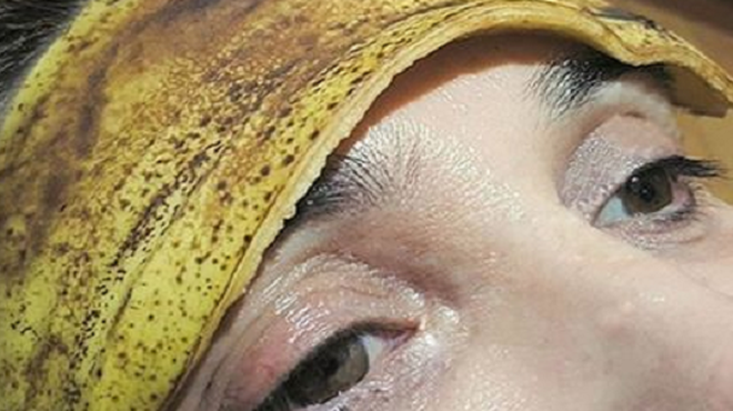 Nov trend: ljudje si na čelo dajejo bananin olupek. Zakaj to počnejo? (foto: Twitter WT Remedies)