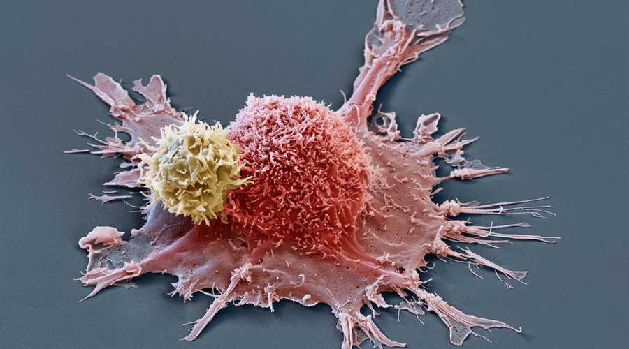 Osupljivo učinkovito zdravilo: VSEM pacientom v raziskavi IZGINIL TUMOR! (foto: profimedia)
