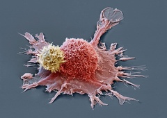 Osupljivo učinkovito zdravilo: VSEM pacientom v raziskavi IZGINIL TUMOR!