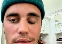 Kako resno je? Vse, kar morate vedeti o redkem sindromu Ramsayja Hunta, ki je paraliziral obraz Justina Bieberja