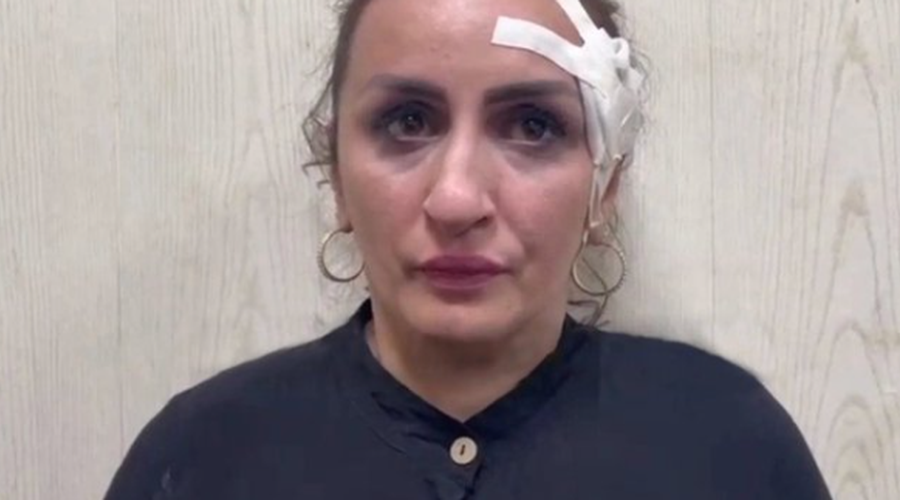 Bizarno: Rusinja je prodala svojega otroka zaradi operacije nosu (foto: Twitter/Fox3 Now)