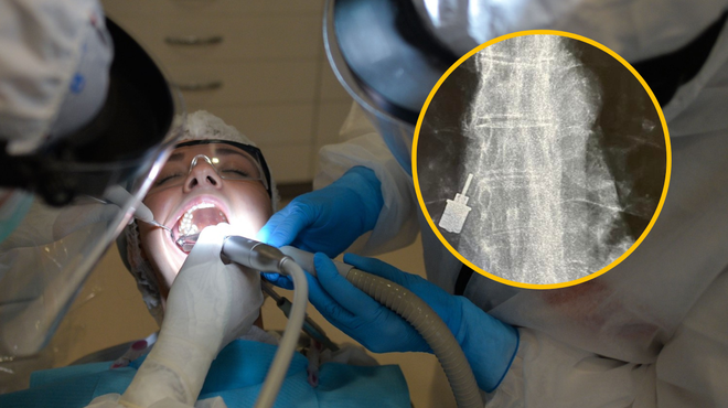 Neposrečen dogodek pri zobozdravniku, zaradi katerega je pacientka pristala na urgenci (foto: Profimedia/Twitter/fotomontaža)