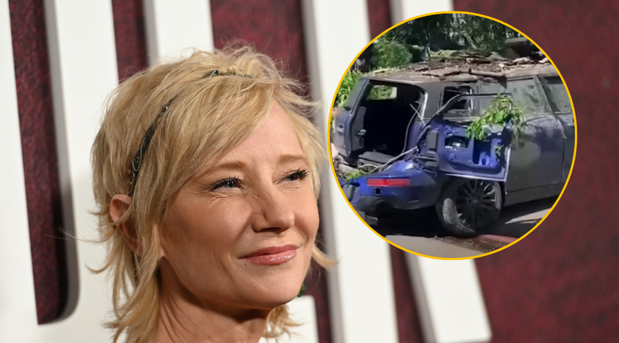 Nekdanja partnerka Ellen DeGeneres po grozljivi prometni nesreči vsa opečena, a ... (foto: Profimedia/Youtube/Nicki Swift/posnetek zaslona/fotomontaža)
