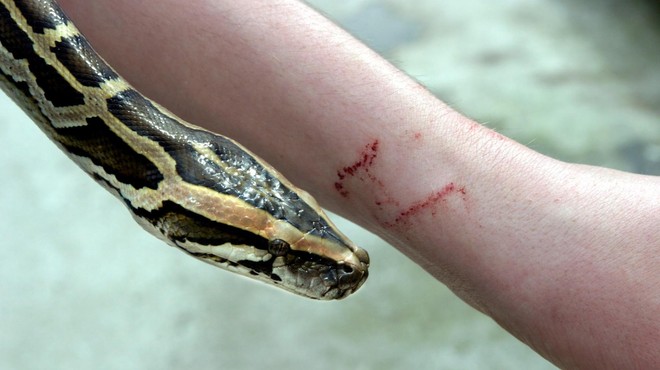 Ugriz kače prepoznamo po dveh ugriznih ranah od kačjih zob. (foto: Profimedia)