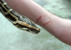 2-letno deklico ugriznila kača: ne boste verjeli, kako se je branila