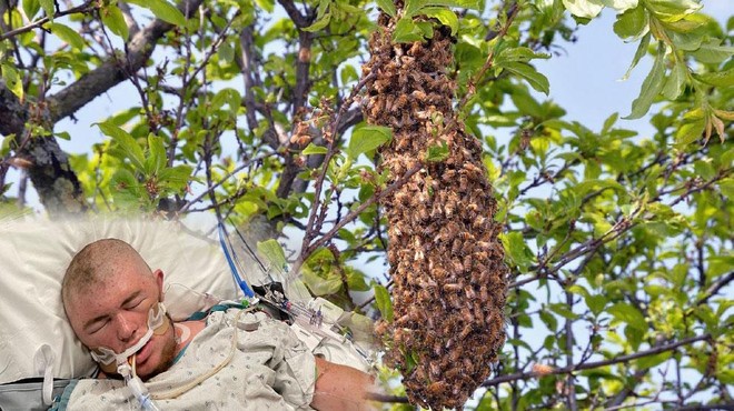 VIDEO: 20-letnik preživel več kot 20.000 čebeljih pikov (foto: Profimedia/Gofundme/Shawna Carter/fotomontaža)