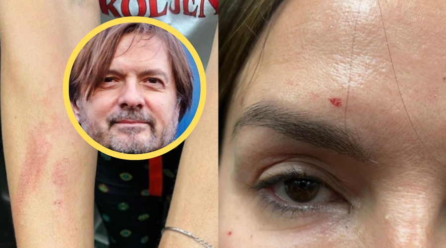 Oglasil se je Severinin nekdanji mož in prilil olje na ogenj družinske drame (foto: Dnevnik.hr/fotomontaža)