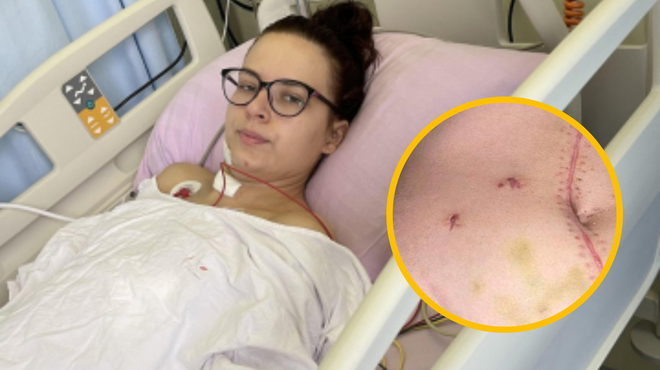 22-letna Vanja Zgonec, ki je preživela napad z nožem: "Tako je moralo biti, da so takšni psihopati zaprti" (foto: Lokalec.si/fotomontaža)