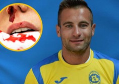 Eni zlomil nos, druga ne sliši več dobro, slovenskemu nogometašu pa le pogojna kazen