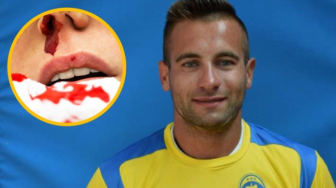 Eni zlomil nos, druga ne sliši več dobro, slovenskemu nogometašu pa le pogojna kazen (foto: KMN Bronx/Profimedia/fotomontaža)