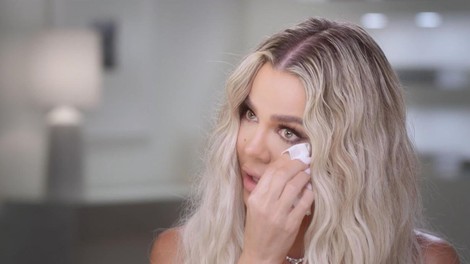 Kardashianova priznala, kaj se skriva pod obližem na obrazu. Razlog ni lepotni poseg