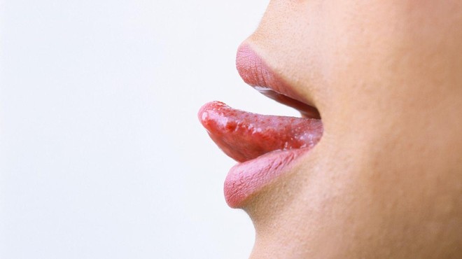 Obstaja več prepričanj – kaj pomeni, če se ugrizneš v jezik? (foto: Pinterest/Jose Perez)