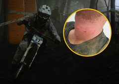 Kolesar se je na Pohorju ujel v smrtonosno past jeznih kmetov: žica mu je skoraj prerezala vrat