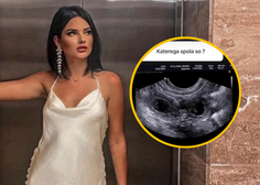 Ana Pusovnik sporočila veselo novico in pokazala sliko ultrazvoka