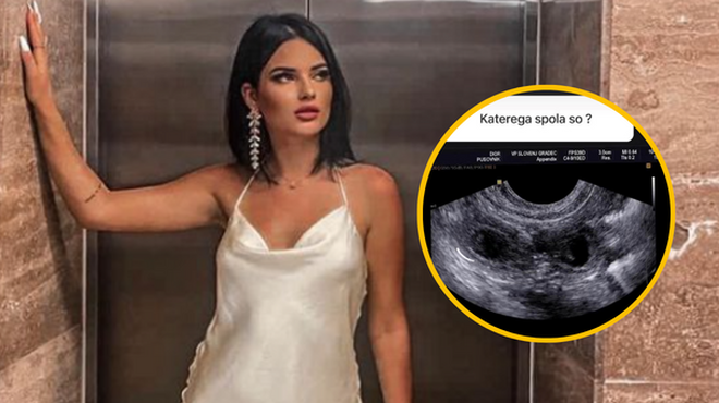 Ana Pusovnik sporočila veselo novico in pokazala sliko ultrazvoka (foto: Instagram/Ana Pusovnik/posnetek zaslona/fotomontaža)