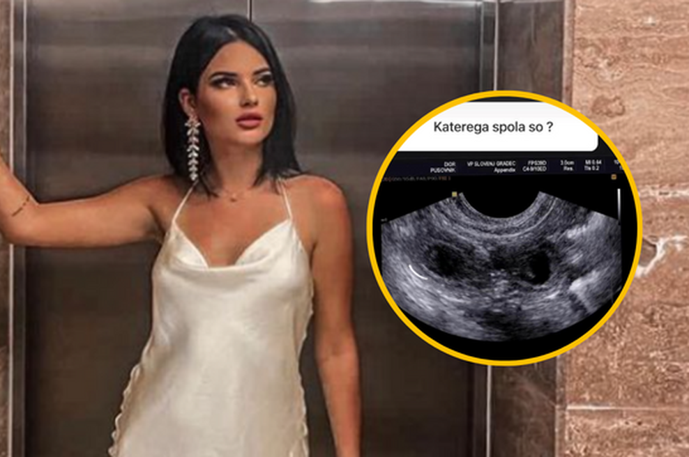 Ana Pusovnik sporočila veselo novico in pokazala sliko ultrazvoka (foto: Instagram/Ana Pusovnik/posnetek zaslona/fotomontaža)