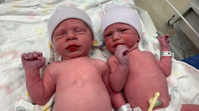 Zarodka sta bila zamrznjena leta 1992, zdaj sta se rodila dvojčka (foto: Twitter/hannah_hardie)