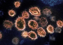 Pri kitajskih netopirjih odkrili nov VIRUS, ki je podoben SARS-CoV 19 (znanstvenike skrbi ena stvar)