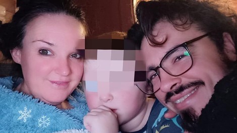 Alenka Gotar se je poškodovala. S fotografijo je pokazala, kako hudo je