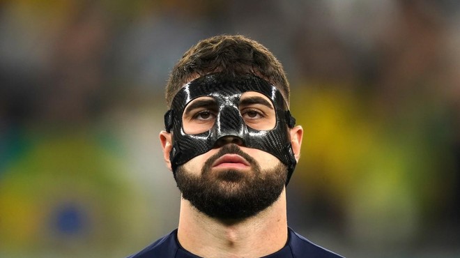 Zakaj hrvaški nogometaš na obrazu nosi skrivnostno masko? (foto: Profimedia)