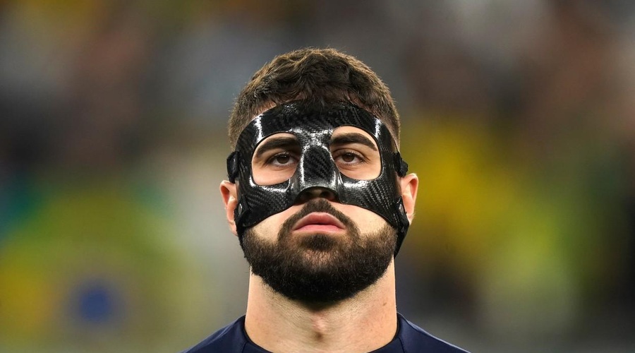 Zakaj hrvaški nogometaš na obrazu nosi skrivnostno masko? (foto: Profimedia)