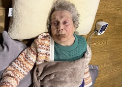 Po padcu je upokojenka kar 25 ur ležala na tleh z zlomljenim kolkom, reševalna služba se ni oglašala na pozive