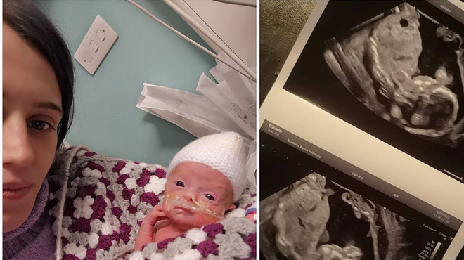 Čeprav so ji zdravniki rekli, da je njen dojenček umrl v maternici, je zaupala svojemu občutku (foto: Instagram/Daily Mail)