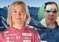 Meta Hrovat ob pretresljivih fotografijah poškodovanega obraza spregovorila o skoraj usodnem padcu