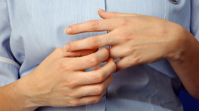 Spremembe na dlaneh lahko nakazujejo na resna obolenja (foto: Profimedia)