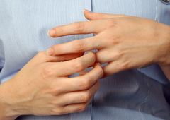 Spremembe na dlaneh lahko nakazujejo na resna obolenja