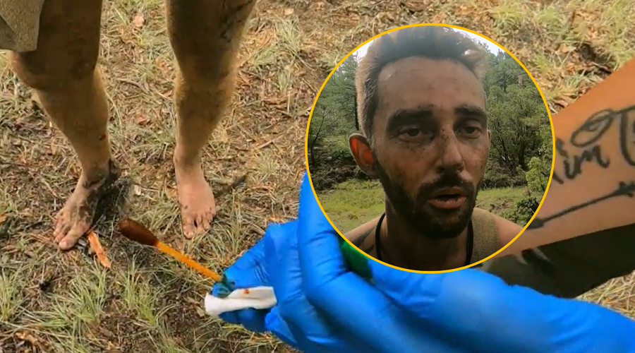 Med snemanjem priljubljene oddaje o preživetju si je tekmovalec zažgal zaklad med nogami (foto: Discovery/posnetek zaslona/fotomontaža)