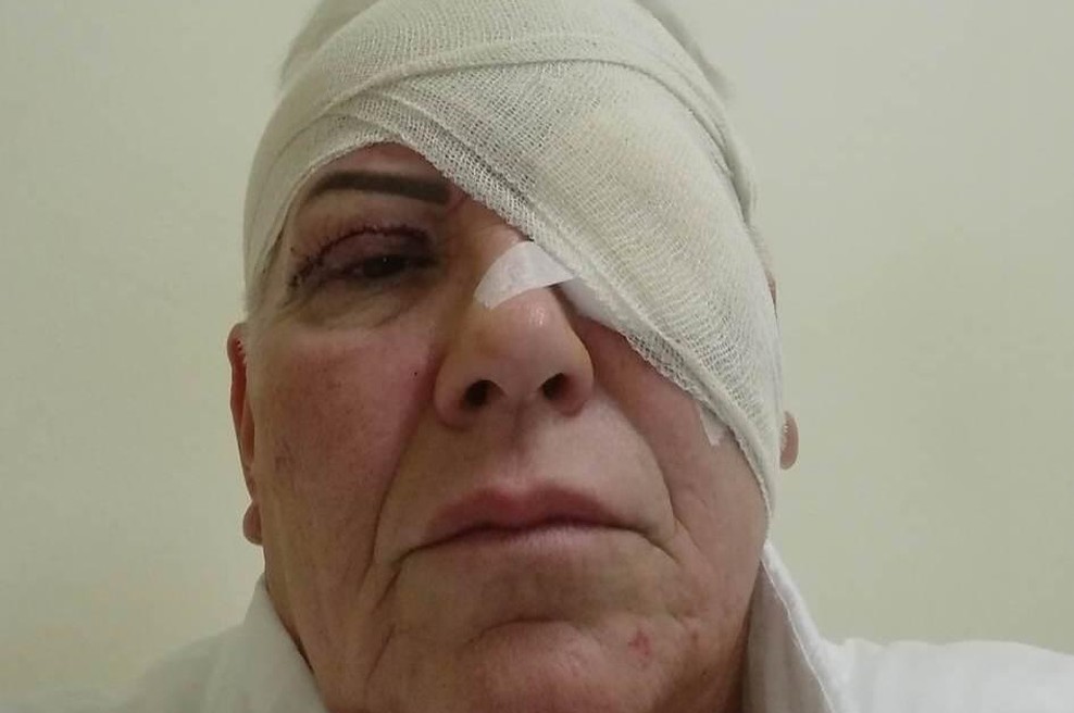 Znana resničnostna zvezdnica prestala lepotno operacijo. Tako je videti zdaj (foto: osebni arhiv)