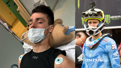 Tim Gajser je moral po zlomu stegnenice pod nož: vemo, ali je bila operacija uspešna